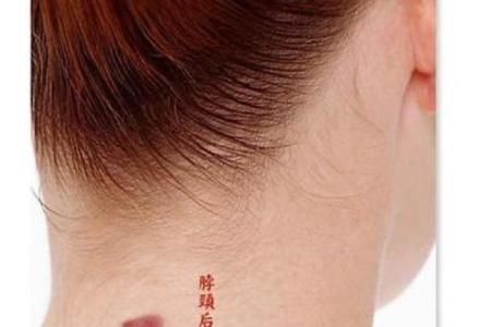 胎记算命：怎么看胎记