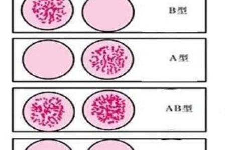 血型可以判断孩子是亲生的吗 血型能鉴定亲子关系吗