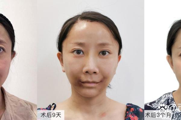 八字纹填充