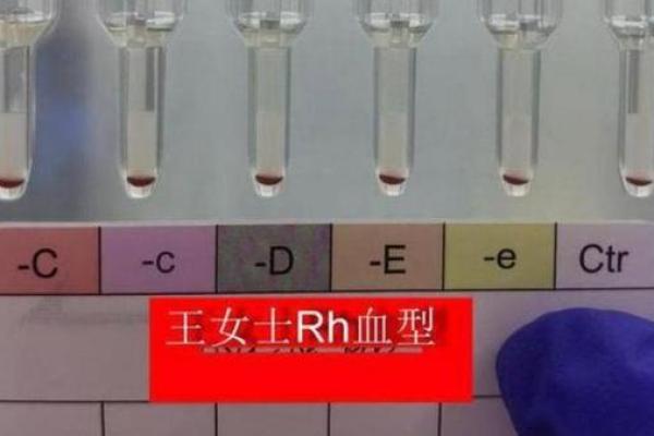 成功人士最多的血型