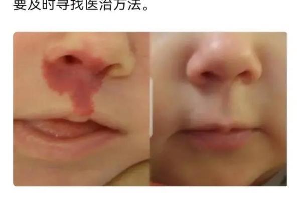 身上胎记算命图解