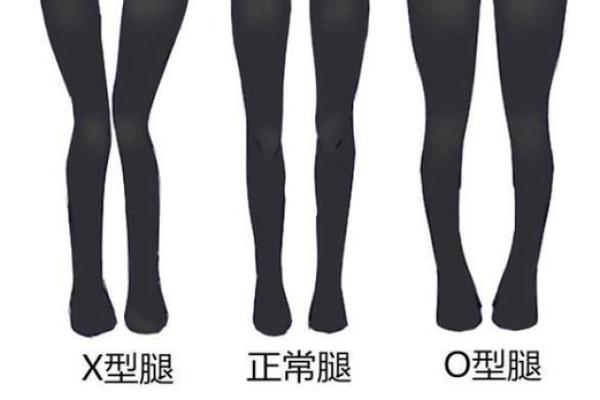 内八字腿型