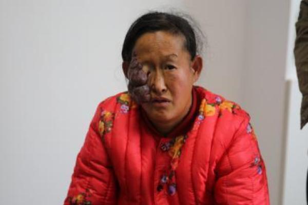 红色的胎记如何看相算命-