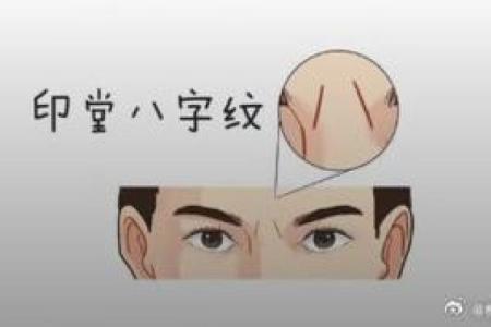 眼角八字