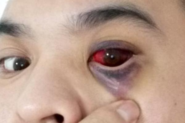 眼睛黑眼珠子多算命